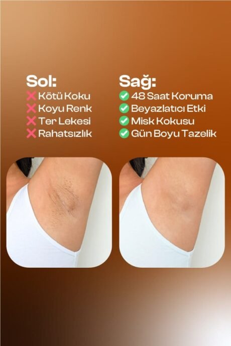 03-3-rollon-Deodorant