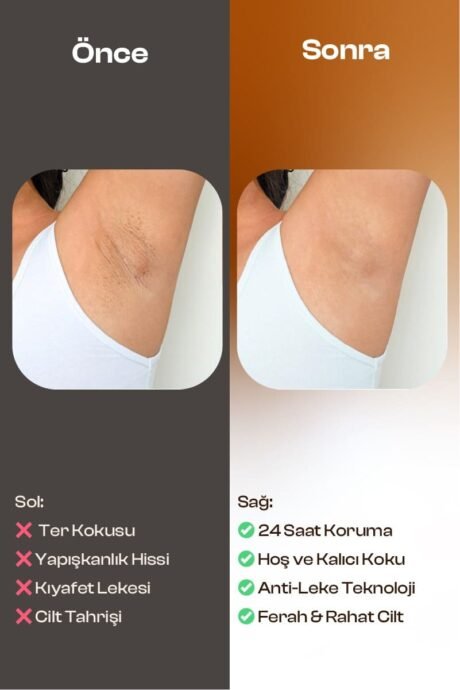 18-3-spray-deodorant